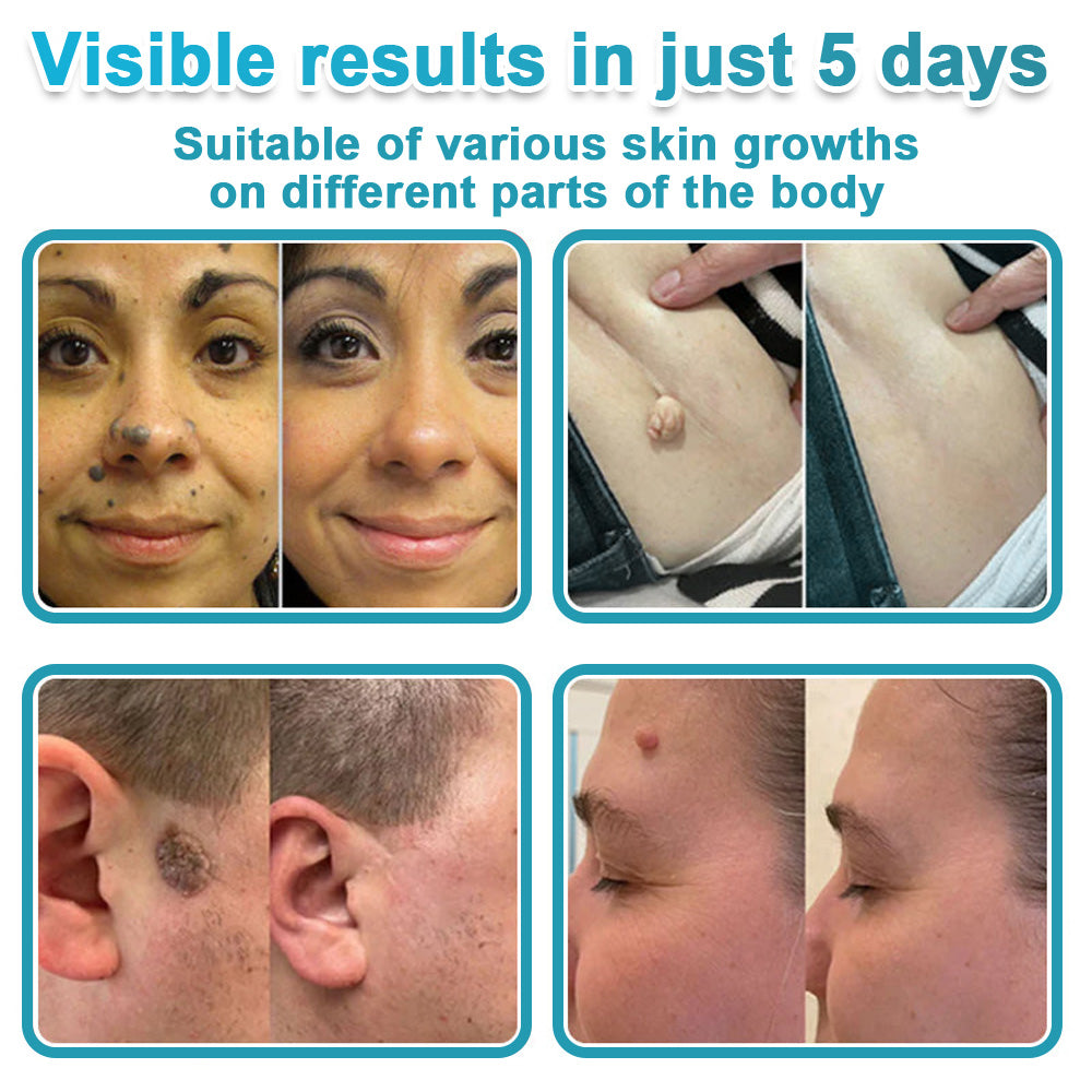 Congratulations! You’re our 500th customer today, and you get to enjoy a special offer: a second product for 80%off!HISKIN®