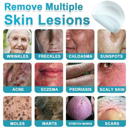 ✨Hiskin ® 2-in-1 Microneedle & Hydrocolloid Patch🍀 | Removes raised moles, acne, flat warts, and skin tags | Helps improve wrinkles, scars, and blemishes | Invisible patches for face and body