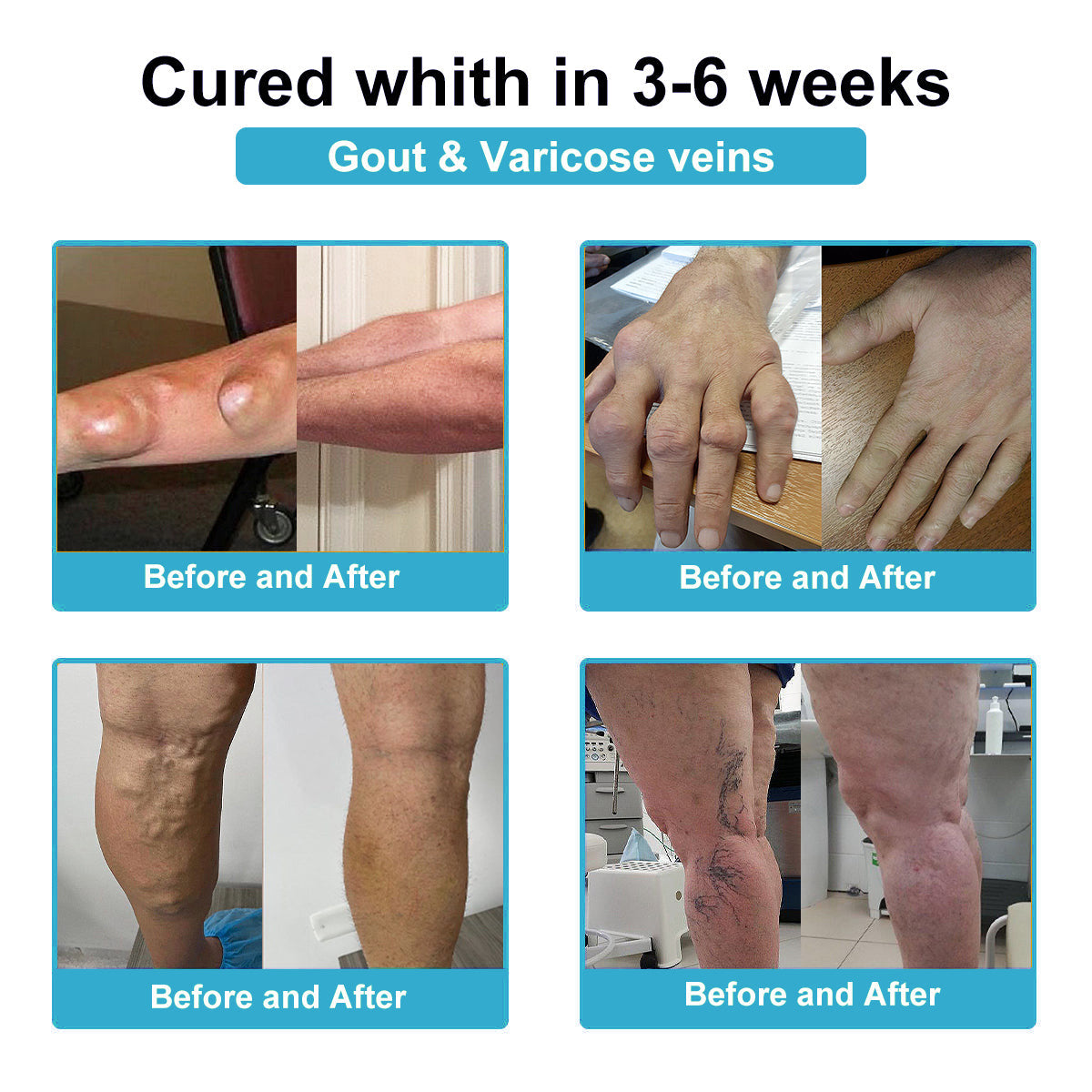 DR.HONOR® All-In-One Joint & Bone Recovery Cream🏆🏆(Specially for older adults)