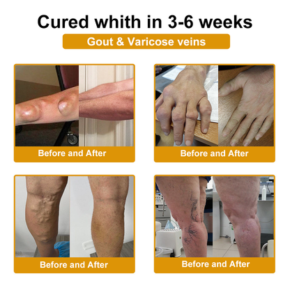 DR.HONOR® All-In-One Joint & Bone Recovery Cream🏆🏆(Specially for older adults)
