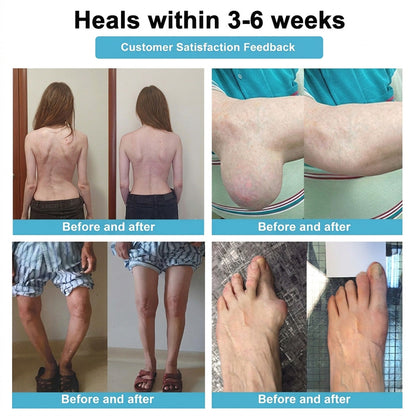 DR.HONOR® All-In-One Joint & Bone Recovery Cream🏆🏆(Specially for older adults)