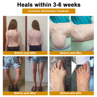 DR.HONOR® All-In-One Joint & Bone Recovery Cream🏆🏆(Specially for older adults)
