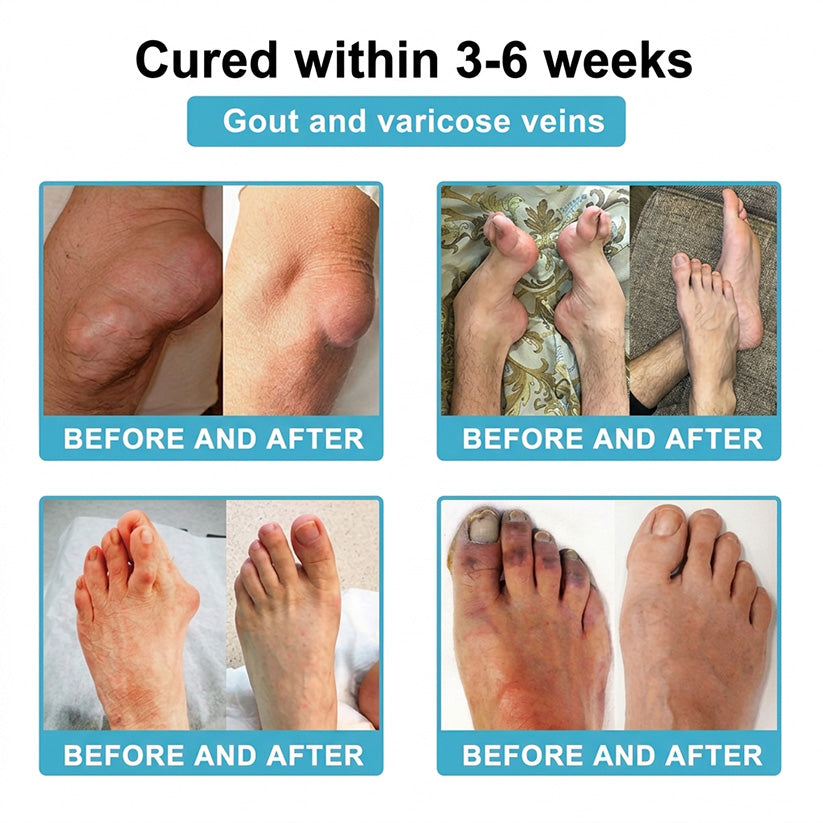 DR.HONOR® All-In-One Joint & Bone Recovery Cream🏆🏆(Specially for older adults)