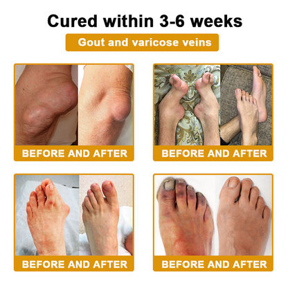DR.HONOR® All-In-One Joint & Bone Recovery Cream🏆🏆(Specially for older adults)